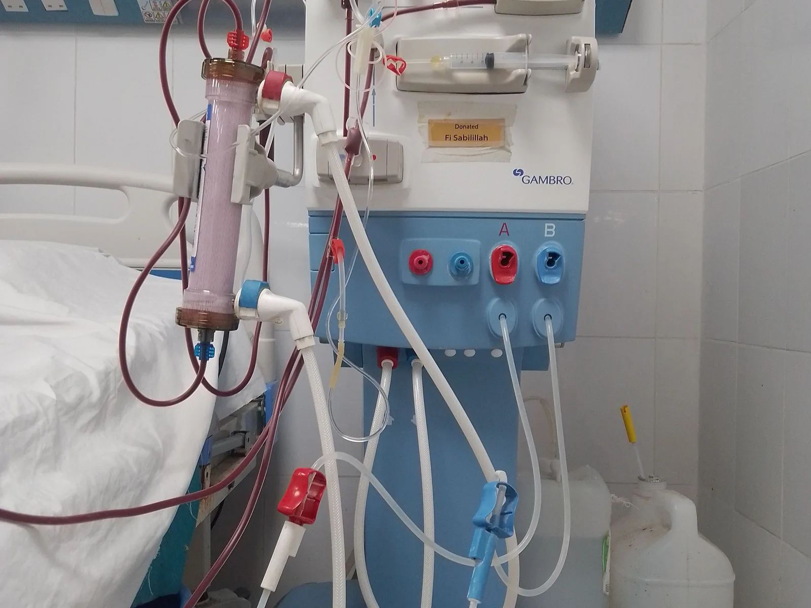 Ein Dialysegerät mit Schläuchen, Filtern und Bedienfeld neben einem Behandlungsplatz.