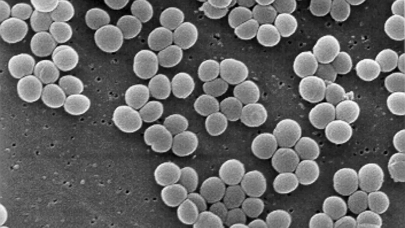 Rasterelektronenmikroskopische Aufnahme in Grautönen: viele kugelförmige Bakterien der Art Staphylococcus aureus, die in kleinen Haufen beieinanderliegen.